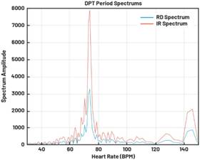 動(dòng)態(tài)離散周期變換技術(shù)突破：無ECG參考的生理信號(hào)精準(zhǔn)解析