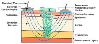  圖5.人體皮膚分層橫截面以及TMD和生物阻抗測(cè)量  考慮到生物阻抗分析的無創(chuàng)性，使用兩個(gè)金屬電極代表電氣傳感器，連接模擬前端(AFE)電路和患者皮膚。這個(gè)金屬與非金屬的接觸點(diǎn)是構(gòu)成整個(gè)電路的另一個(gè)關(guān)鍵部分，連接了AFE和人體電氣模型。電荷載體（電極中的電子和人體內(nèi)的離子）之間的相互作用可能對(duì)這些傳感器的性能產(chǎn)生重大影響，需要根據(jù)每種應(yīng)用進(jìn)行具體考慮。首先，金屬與離子溶液接觸的相互作用導(dǎo)致金屬表面附近溶液中離子濃度的局部變化。這種現(xiàn)象會(huì)改變電極下方區(qū)域的電荷中性，導(dǎo)致金屬周圍的電解質(zhì)電位與溶液其余部分不同，從而在金屬和電解質(zhì)主體之間產(chǎn)生一個(gè)電位差，即常說的“半電池電位”。其次，注入電流的直流分量會(huì)導(dǎo)致電極極化。  表1.各種電極類型和相應(yīng)的半電池電位  金屬及反應(yīng)  半電池電位(V)  Al → Al3+ + 3e- Al → Al3+ + 3e-  –1.706 –1.706  Ni → Ni2+ + 2e- Ni → Ni2+ + 2e-  –0.230 -0.230  H2 → 2H+ + 2e- H2 → 2H+ + 2e-  0.000 (by definition) 0.000（根據(jù)定義）  Ag + Cl- → AgCl + e- Ag + Cl- → AgCl + e-  +0.223 +0.223  Ag → Ag+ + e- Ag → Ag+ + e-  +0.799 +0.799  Au → Au+ + e- Au → Au+ + e-  +1.680 +1.680  這是一種不良現(xiàn)象，往往導(dǎo)致電極性能下降。這些考量表明，電極也需要定義適當(dāng)?shù)碾姎饽Ｐ停▍⒁妶D6）。我們可以將干電極表示為具有三個(gè)串聯(lián)元件的電路：一個(gè)用于模擬半電池電位(EHC)的直流電源；一個(gè)用于模擬金屬和非金屬（人體）之間接觸的RC并聯(lián)電池(Rd||Cd)；以及一個(gè)用于模擬電極金屬的電阻Rs。